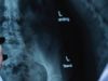 X-ray Interpretation