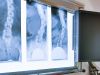 Chiropractic Radiology 